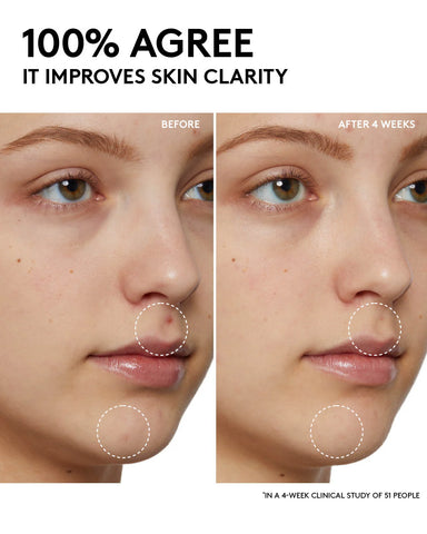 Fenty Skin Start’rs Full-Size Bundle: Oily Skin Edition